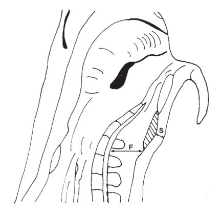 Druck- und Lokalversion